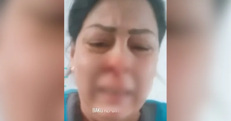 Xəstəxana direktoru işçini döyüb? Video