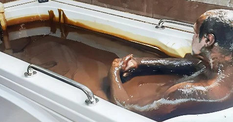 Azərbaycanda kişi sanatoriyada öldü