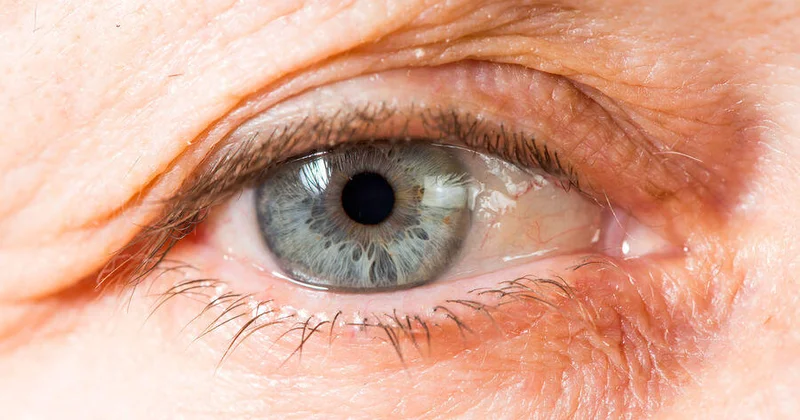 Найден способ снизить риск возрастной потери зрения