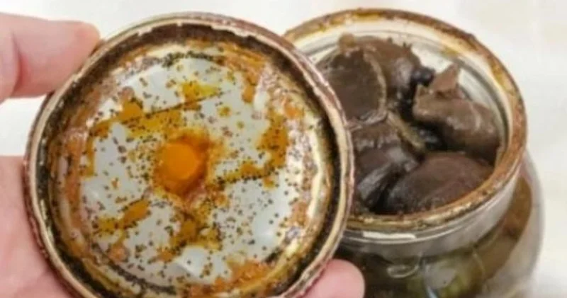 Botulizm nədir və nə üçün təhlükəlidir?