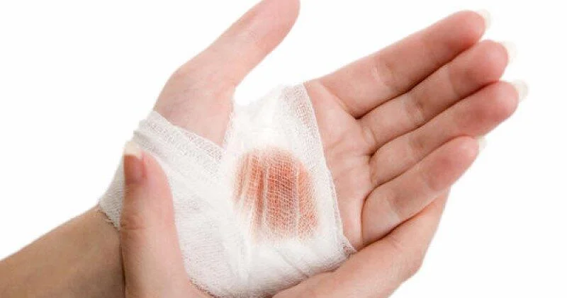 Раскрыт неожиданный фактор медленного заживления ран