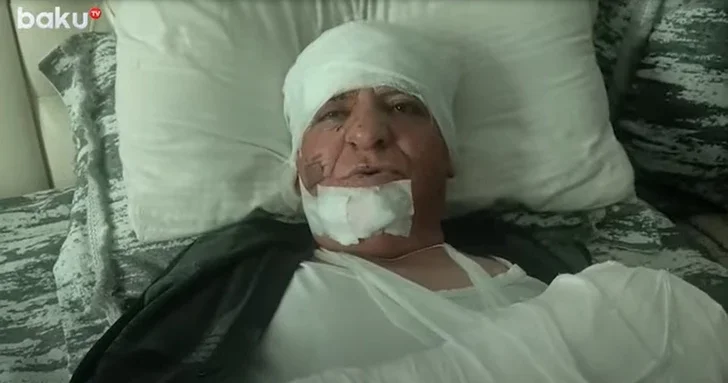 Девушка молчала, парень кричал свидетельства пострадавшего при взрыве в Баку