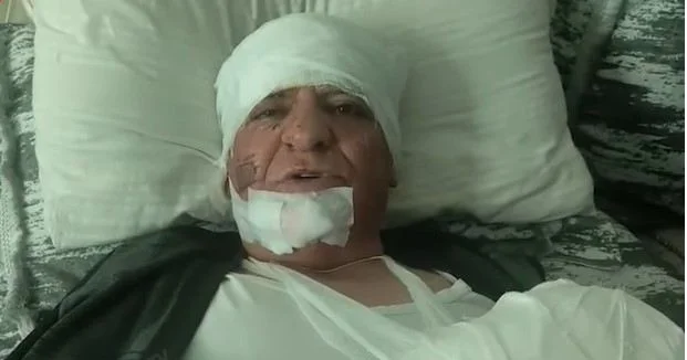 Nərimanovdakı partlayışda yaralanan şəxs danışdı: “Hamısı töküldü üstümə, məni qan aparırdı” VİDEO