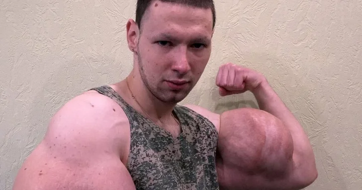 Треш блогеру Руки Базуки грозит скорая ампутация