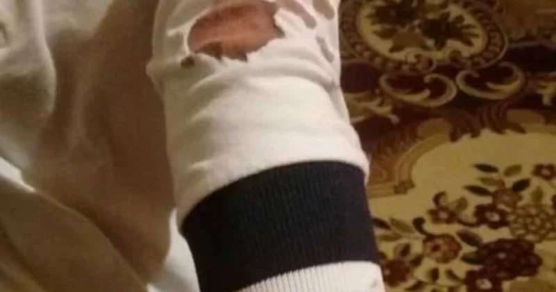 Məktəbdə qolu sınan 8 yaşlı uşaq öldü