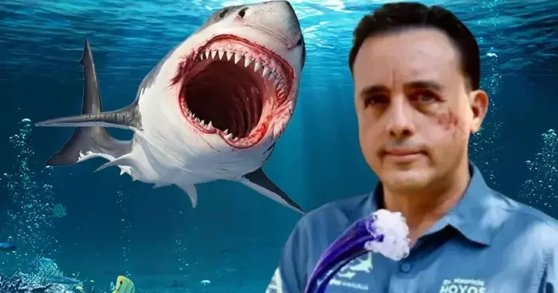 Köpək balığı üzünü dişlədi, sağ qaldı! “İstəsəydi öldürə bilərdi”