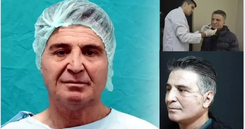 Dövlət xəstəxanasında bir ilk!&nbsp;Əməliyyatdan 15 il cavanlaşaraq çıxdı