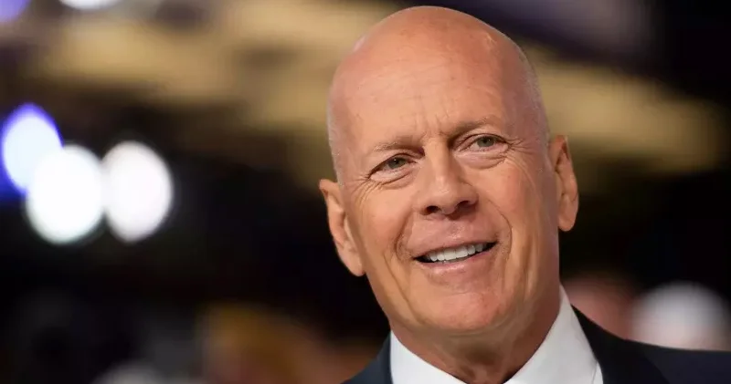 Məşhur aktyorun beyni bağışlanacaq Həyat yoldaşı qərar verdi