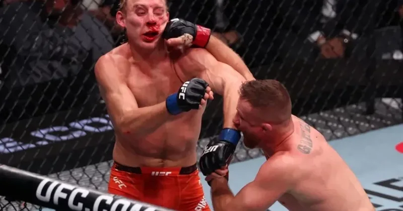 Peddi Pimblett döyüşdən dərhal sonra xəstəxanaya göndərilib VİDEO