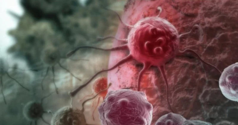 Xərçəngə qarşı şok inqilab: Yeni immunterapiya metastazları məhv etdi