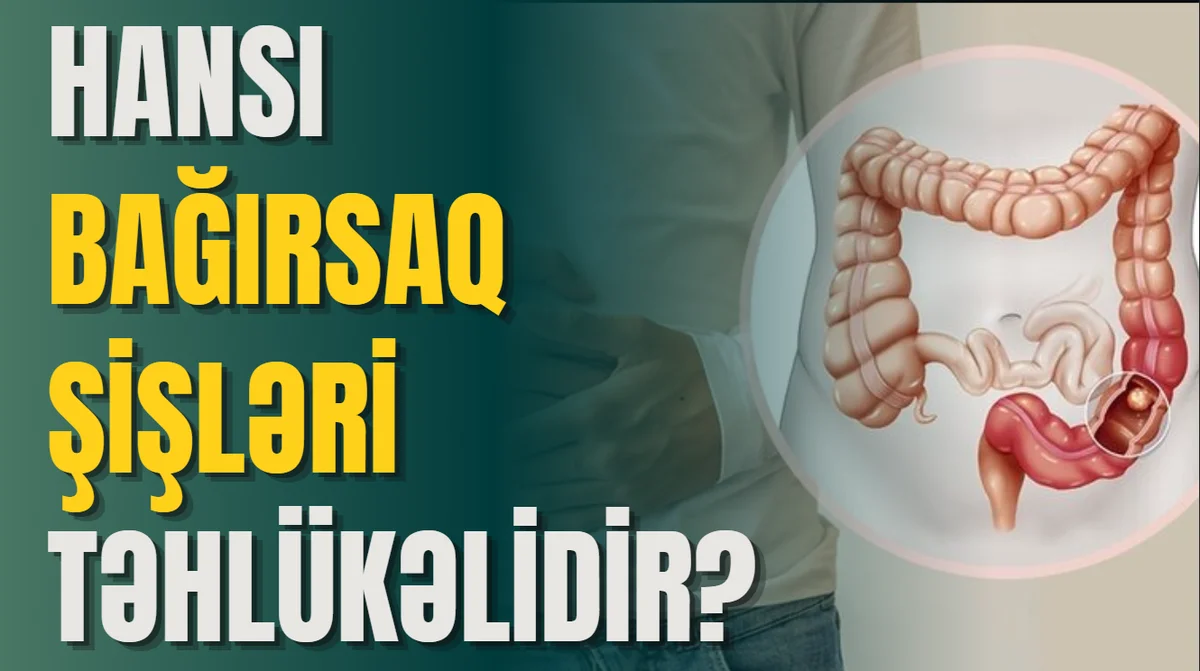 Bağırsaq qanamaları nədir? Simptomlar və müalicə üsulları