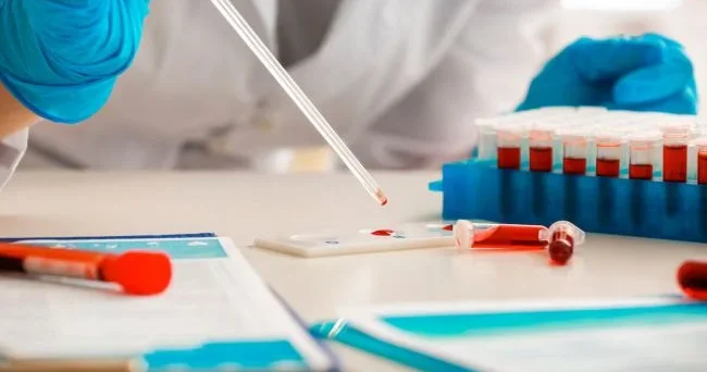 Bir damla qan xərçəngi 94,9% dəqiqliklə AŞKARLAYIR
