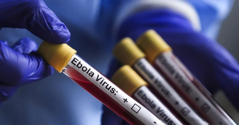 ÜST: Konqoda “Ebola” virusu ilə bağlı vəziyyət ağırlaşır