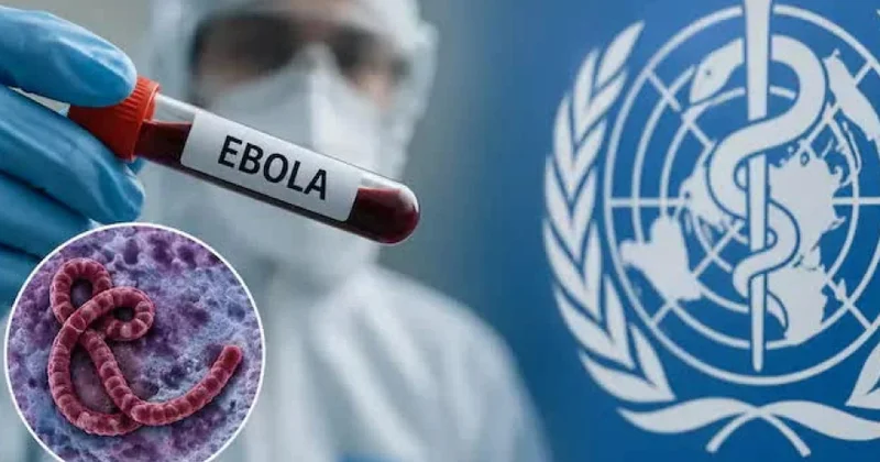 “Africa CDC” Ebola virusunun Afrikanın 10 ölkəsinə yayılması riski barədə xəbərdarlıq edib