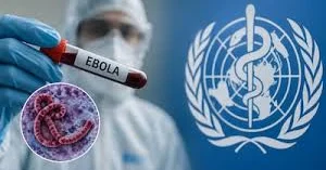 ÜST dən beynəlxalq XƏBƏRDARLIQ: Ebolaya yoluxma...