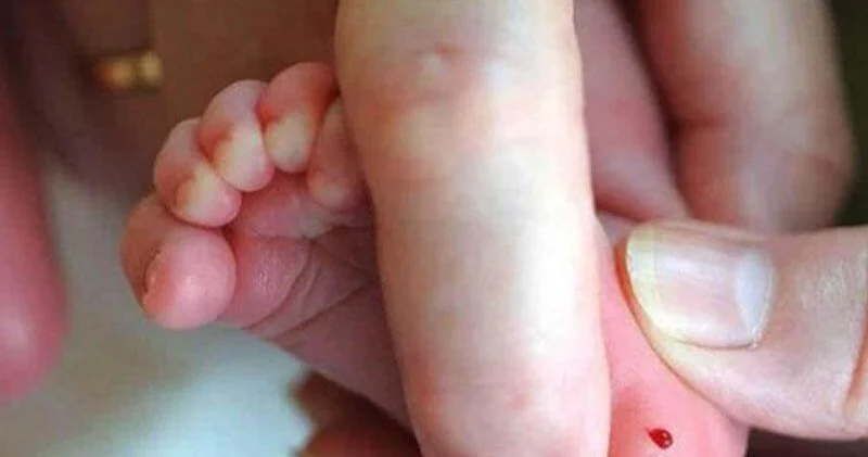 Daban testi mütləq lazımdır: Erkən diaqnoz uşağın gələcəyini xilas edir