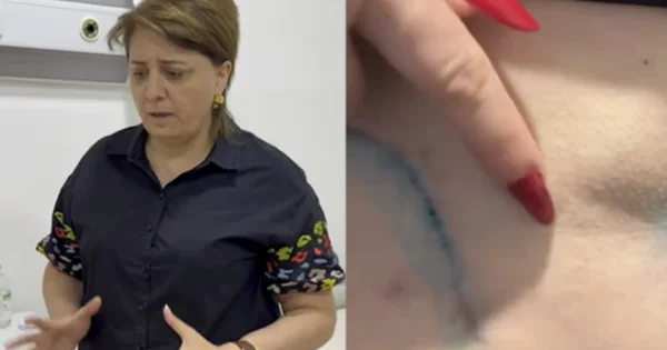 Bədənim çürüyür” Daha bir “plastik cərrah” qalmaqalı (VİDEO)