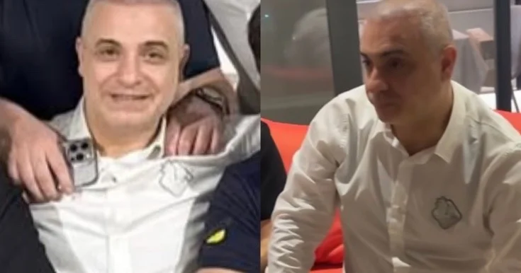 Rüfət Axundov saç əkdirib