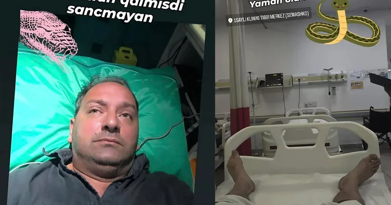 Elnur Kərimovu ilan sancdı Foto