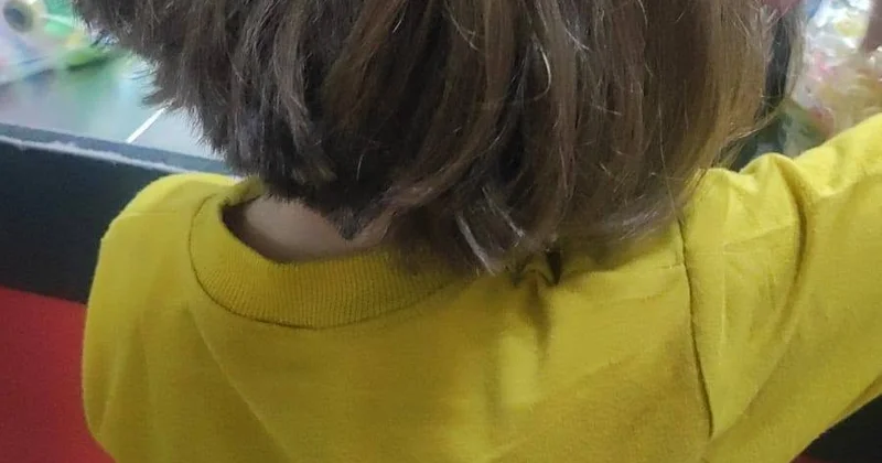 Burnu sınıqdır, bədənində göyərmələr var 9 yaşlı qız zorakılığa məruz qalıb? FOTO