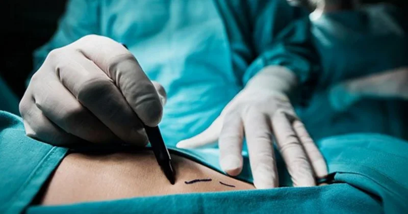 Azərbaycanda TikToker yayım açıb plastik əməliyyata pul yığdı izləyiciləri təhqir etdi FOTO