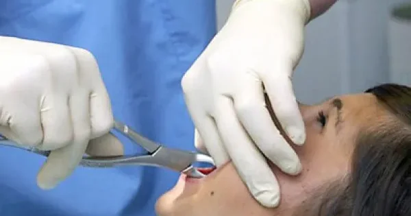 Diş çəkilərkən sinirə toxunmaq ölümə səbəb ola bilərmi? Stomatoloq AÇIQLADI
