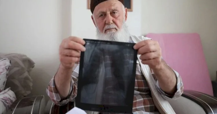 Siqaretə görə 3 barmağını itirdi FOTOLAR KONKRET