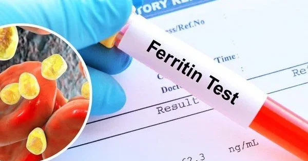 Əksəriyyətin ferritin haqqında bilmədiyi VACİB MƏLUMAT