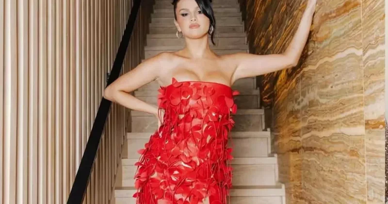 Selena da estetik qurbanı oldu FOTO