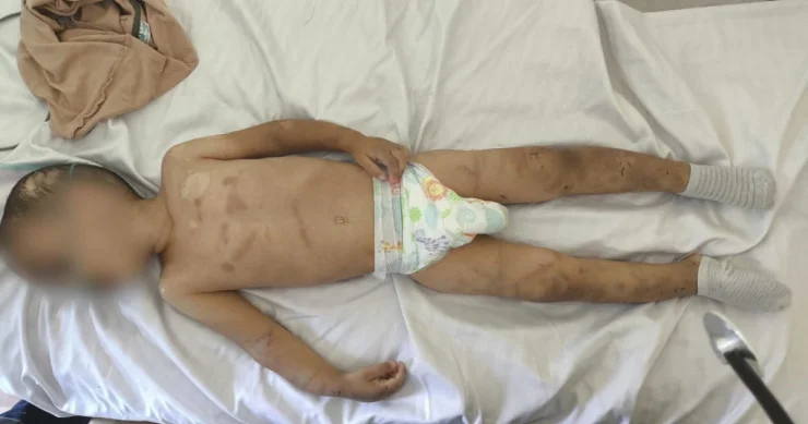 Ağdamda valideynlərin zorakılıq etdiyi uşaqdan xəbər var