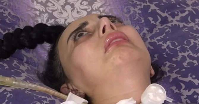 Burun əməliyyatına sağlam girib iflic olaraq çıxdı: Cərrah isə aparatın işləmədiyini deyir