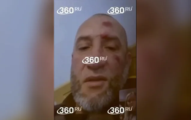 “Sağ qalıbqalmadığını bilmirəm, lakin işini layiqincə icra etdi...” Video