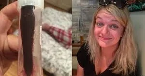 Burnuna zəli girdi, xəbəri olmadı