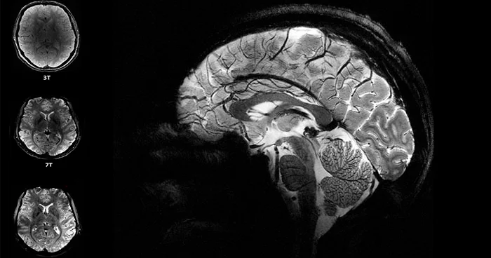 Amerikalı alimlər beyinin təmizlənməsi üçün yeni “mərkəz” aşkar ediblər