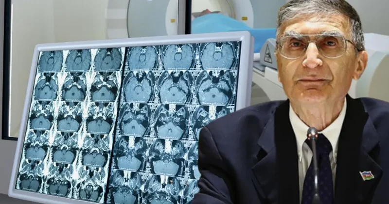 Beyin şişi müalicəsində yenilik Türk aliminin kəşfi