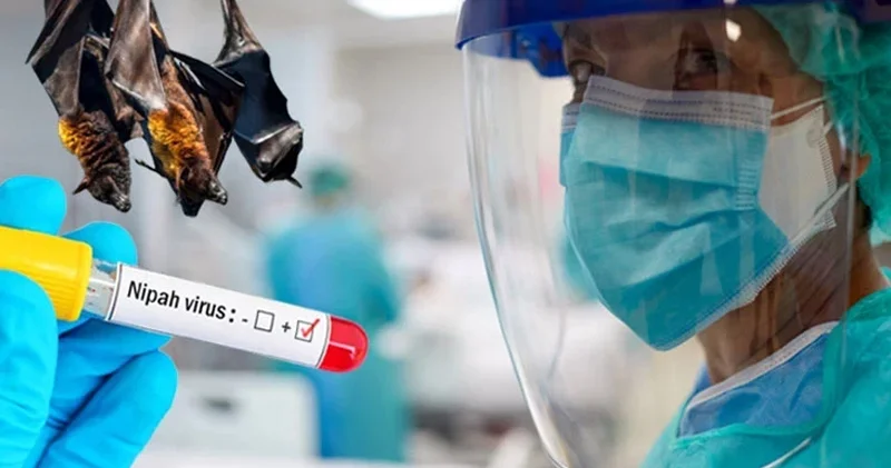ÜST həyəcan təbili çalır: Nipah yeni pandemiyaya səbəb ola bilərmi?