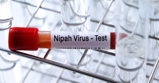 COVID bitdi, Nipah başladı: 10 dəfə çox öldürür