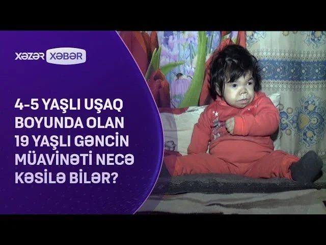 Bu uşağın 19 yaşı var Nadir diaqnoz