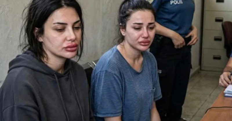 Oğurladıqları telefonu satıb, dodaq dolğusu etdirdilər