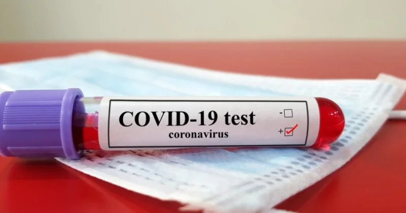 COVİD 19 yenidən sürətlə yayılır