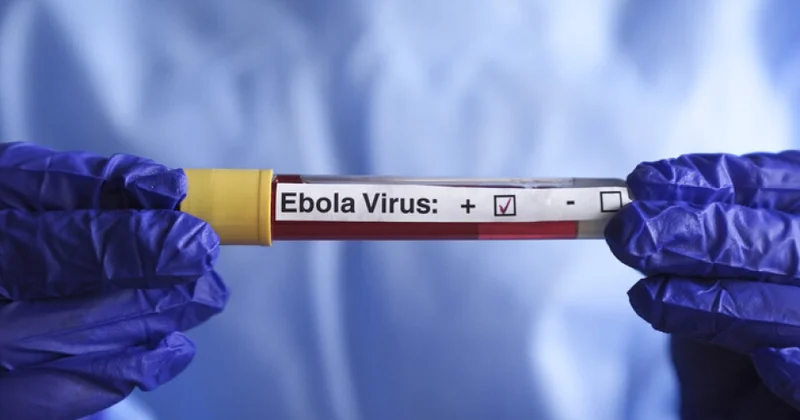 Konqoda Ebolaya yoluxanların sayı 5 656 ya çatıb