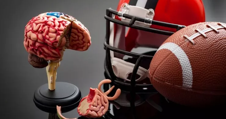 NFL oyunçularının dörddə birində CTE əlamətləri aşkarlandı