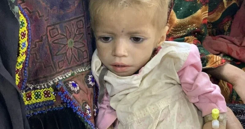 UNICEF: Əfqanıstanda 3,7 milyon uşaq qidalanma çatışmazlığından əziyyət çəkir