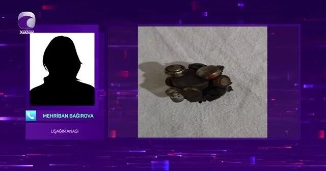 Batareya və maqnit qırıntıları udan 10 yaşlı uşağın anası DANIŞDI VİDEO