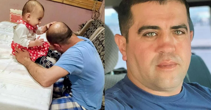 4 manata keçəllikdən ömürlük qurtuldu FOTO