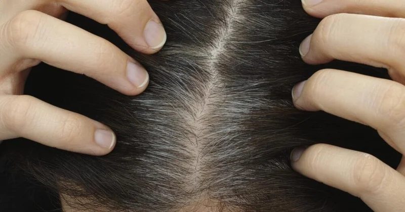 Saçlar niyə vaxtından tez ağarır? Stresslə əlaqəsi yoxdur