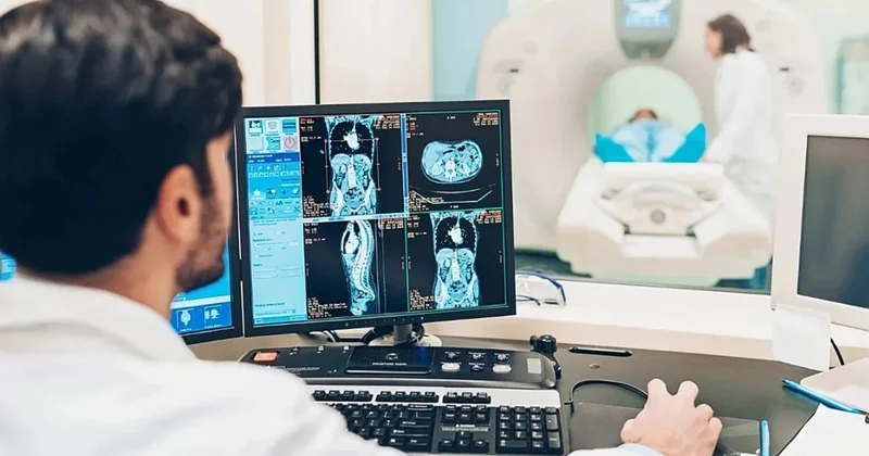 Süni intellekt stresin görüntüsünü aşkar elədi