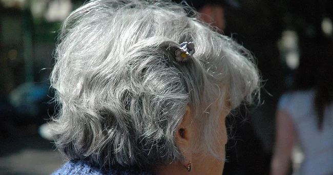 Saçlar niyə ağarır? Yeni araşdırma hamını təəccübləndirdi