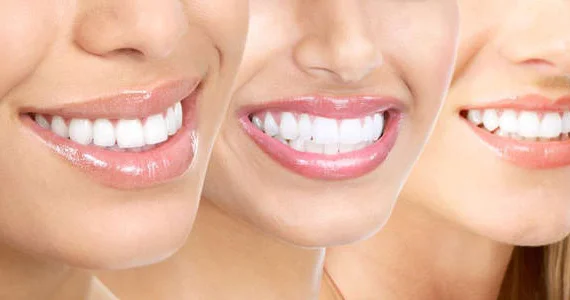 Dişlərinizi bu üsullarla evdə qar kimi ağardın: Çiyələk, kokos yağı...