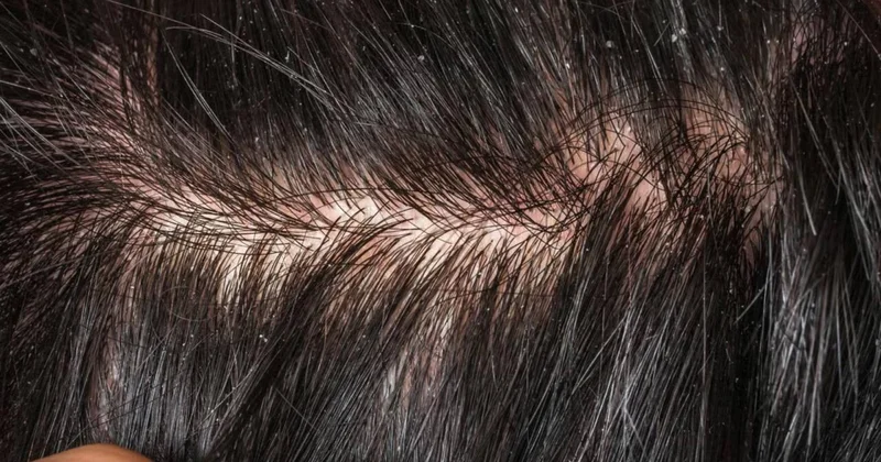 Çox addam ciddiyə almır Ağır xəstəliklərin əlaməti ola bilər